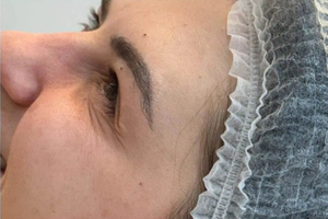 After image