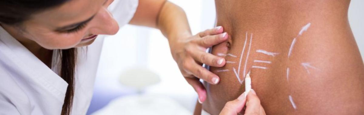 Lipo Enzimática Ribeirão Pires