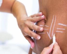 Lipo Enzimática Ribeirão Pires
